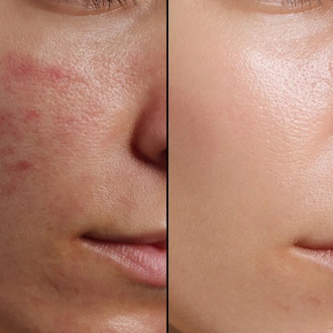 Crema Aloe Vera & Olive Oil & Elicina